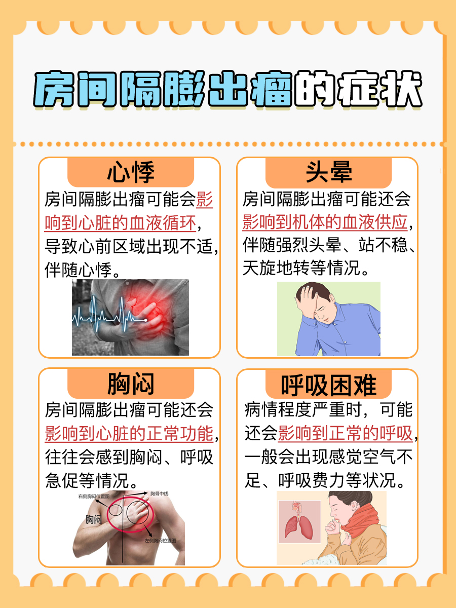 房间隔膨出瘤到底是什么？一文带你了解