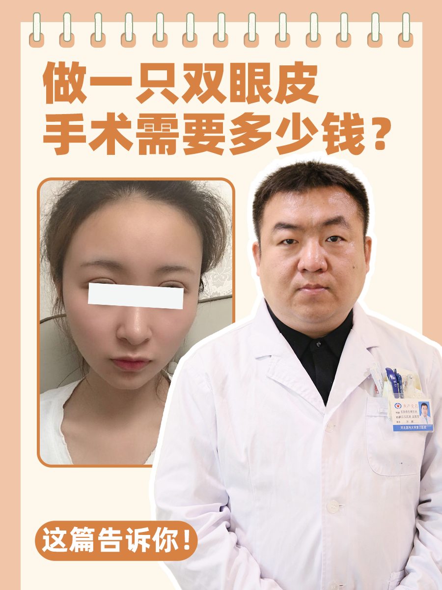 做一只双眼皮手术需要多少钱?这篇告诉你!