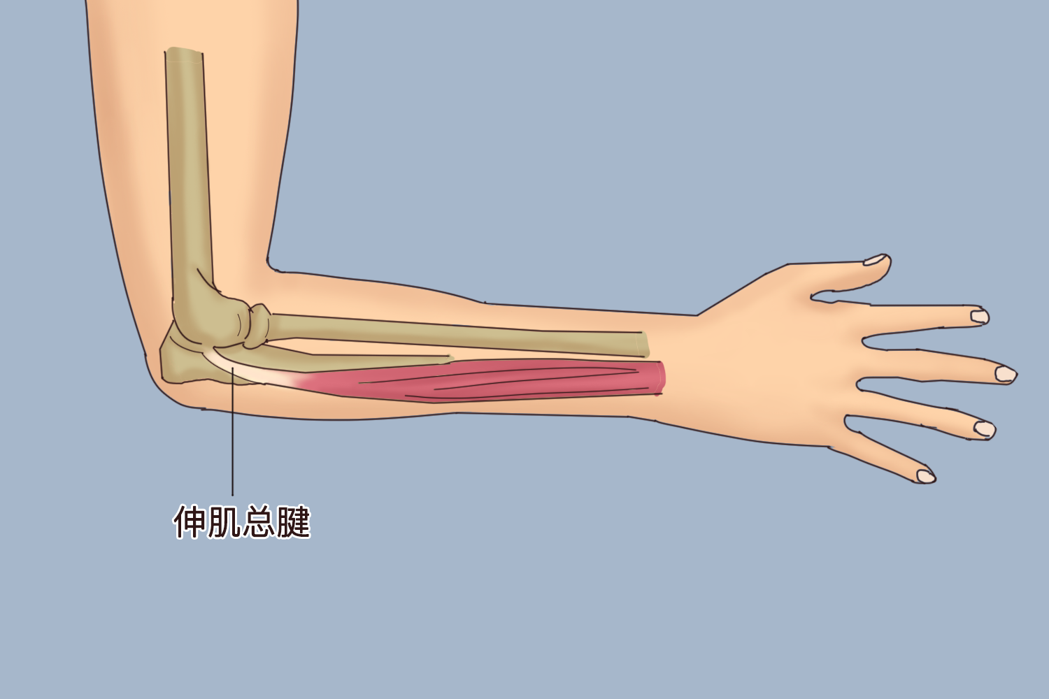 肘关节伸肌总腱位置图图片