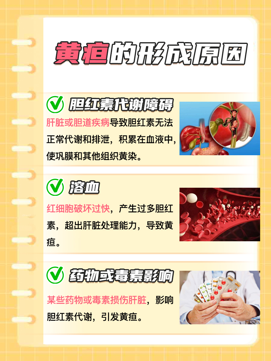轻度黄疸眼睛图片