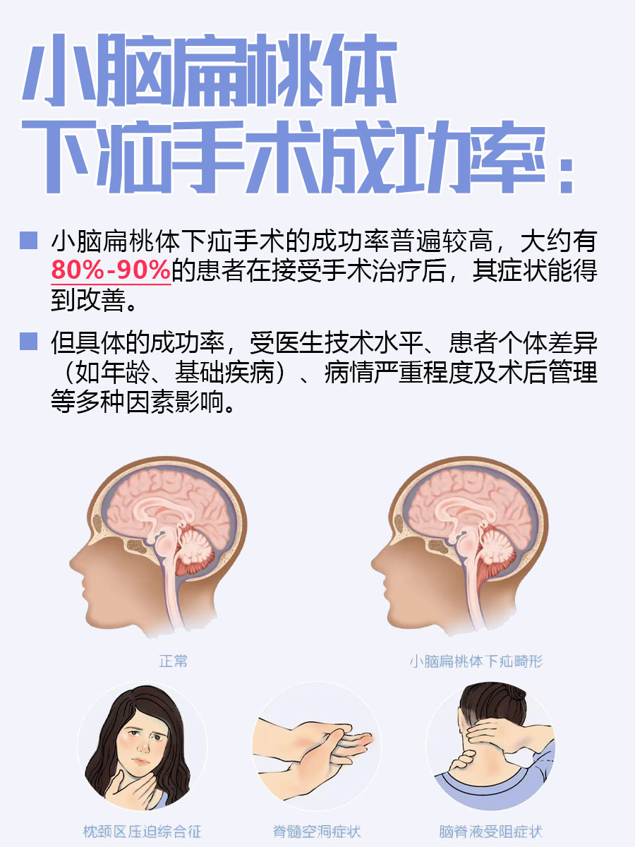 别人不会说的，关于小脑扁桃体下疝手术成功率