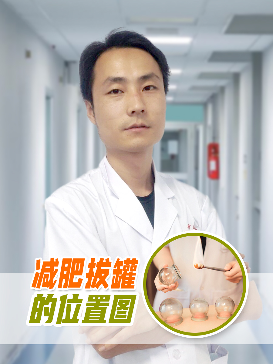 减肥拔罐的位置图