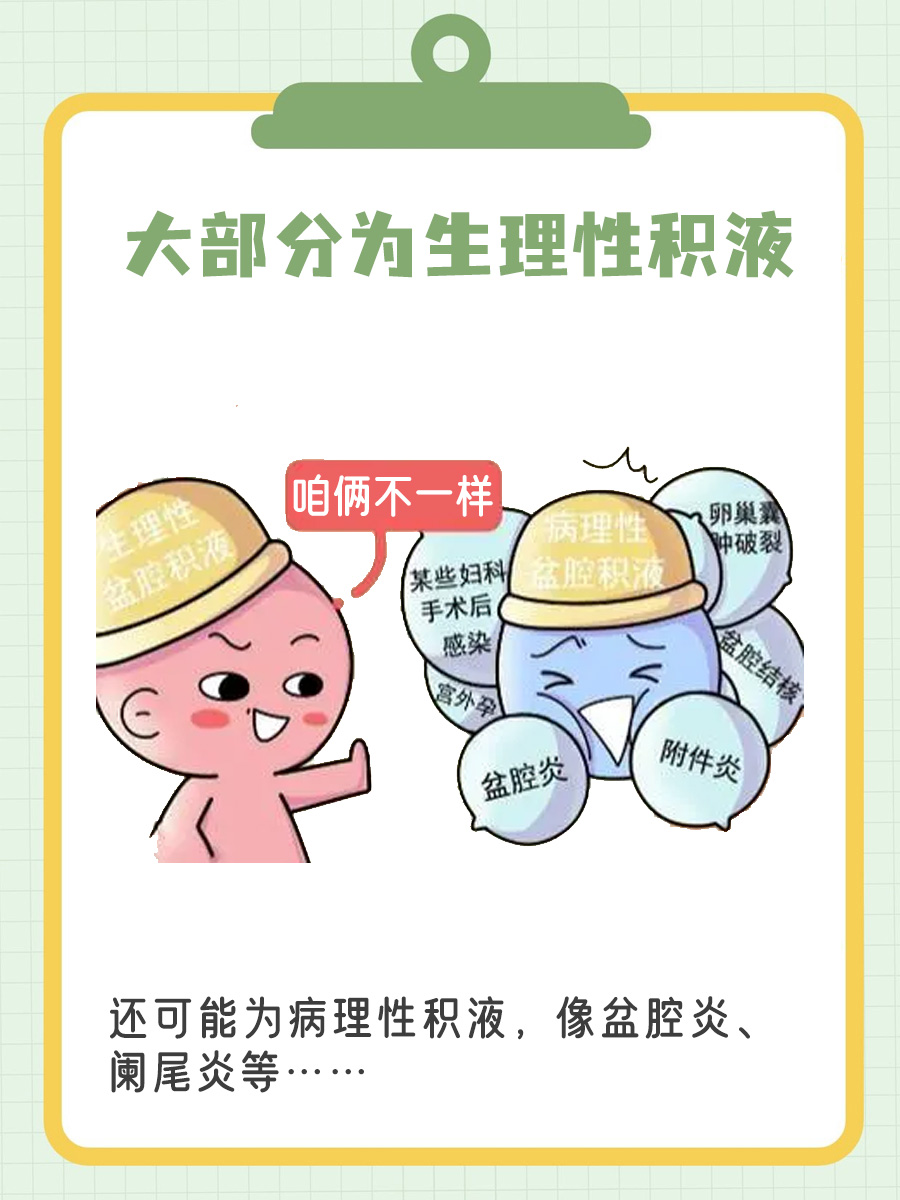 陶氏腔积液是什么？来这里，轻松了解积液奥秘