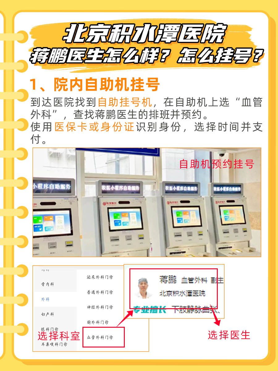 北京积水潭医院蒋鹏医生怎么样？怎么挂号？