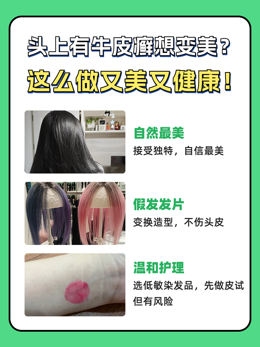 头上有牛皮癣的患者，最好不要染发！🚫