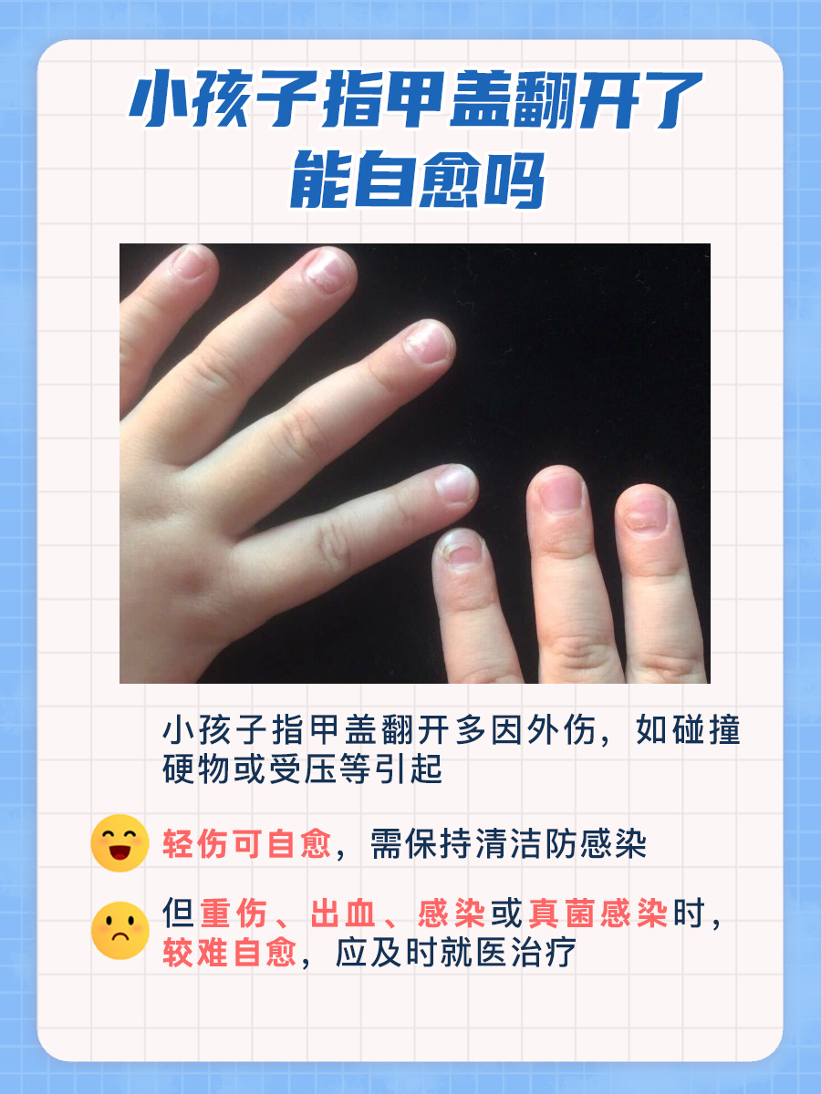 揭秘：孩子指甲盖翻开了能自愈吗