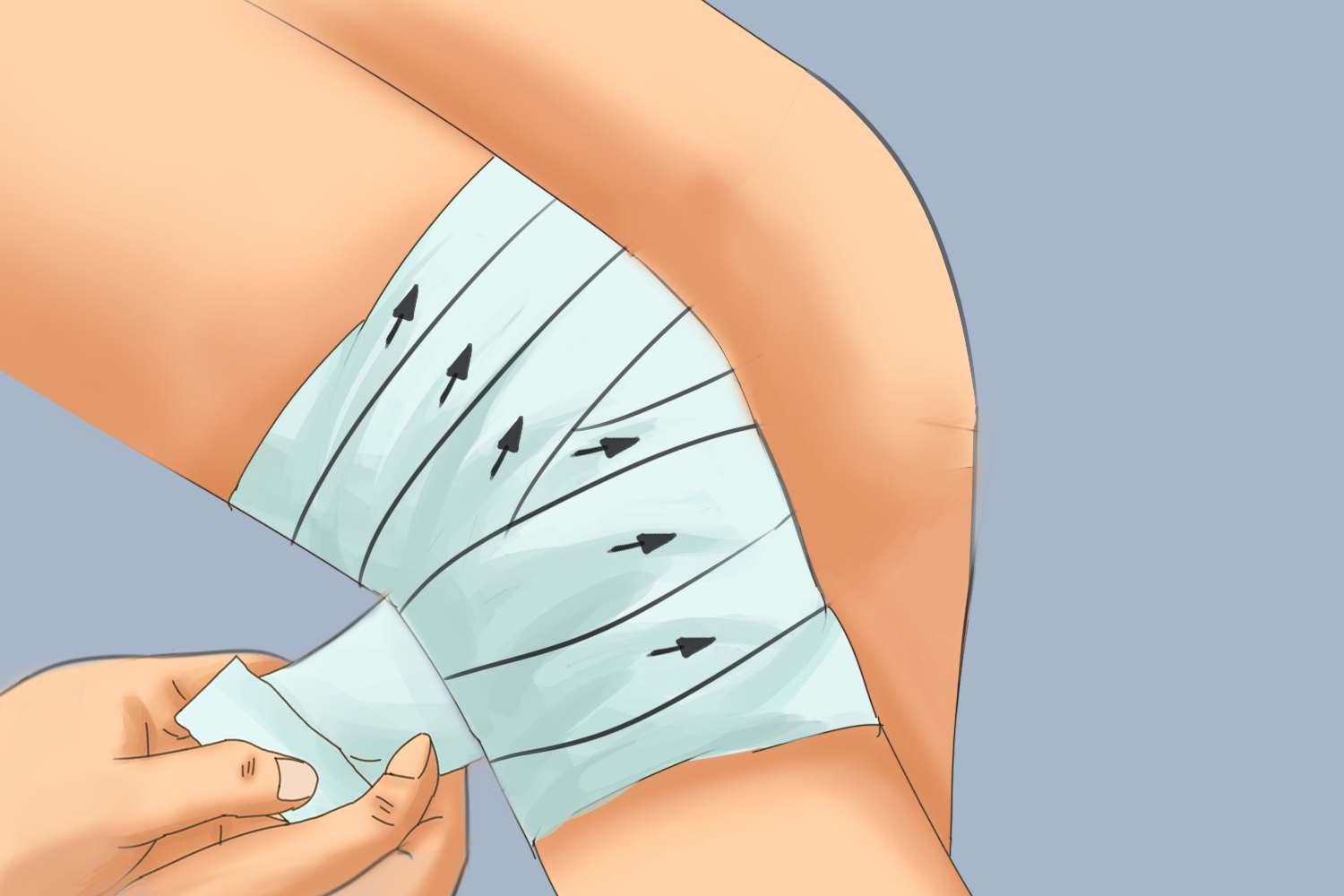 韧带拉伤包扎图