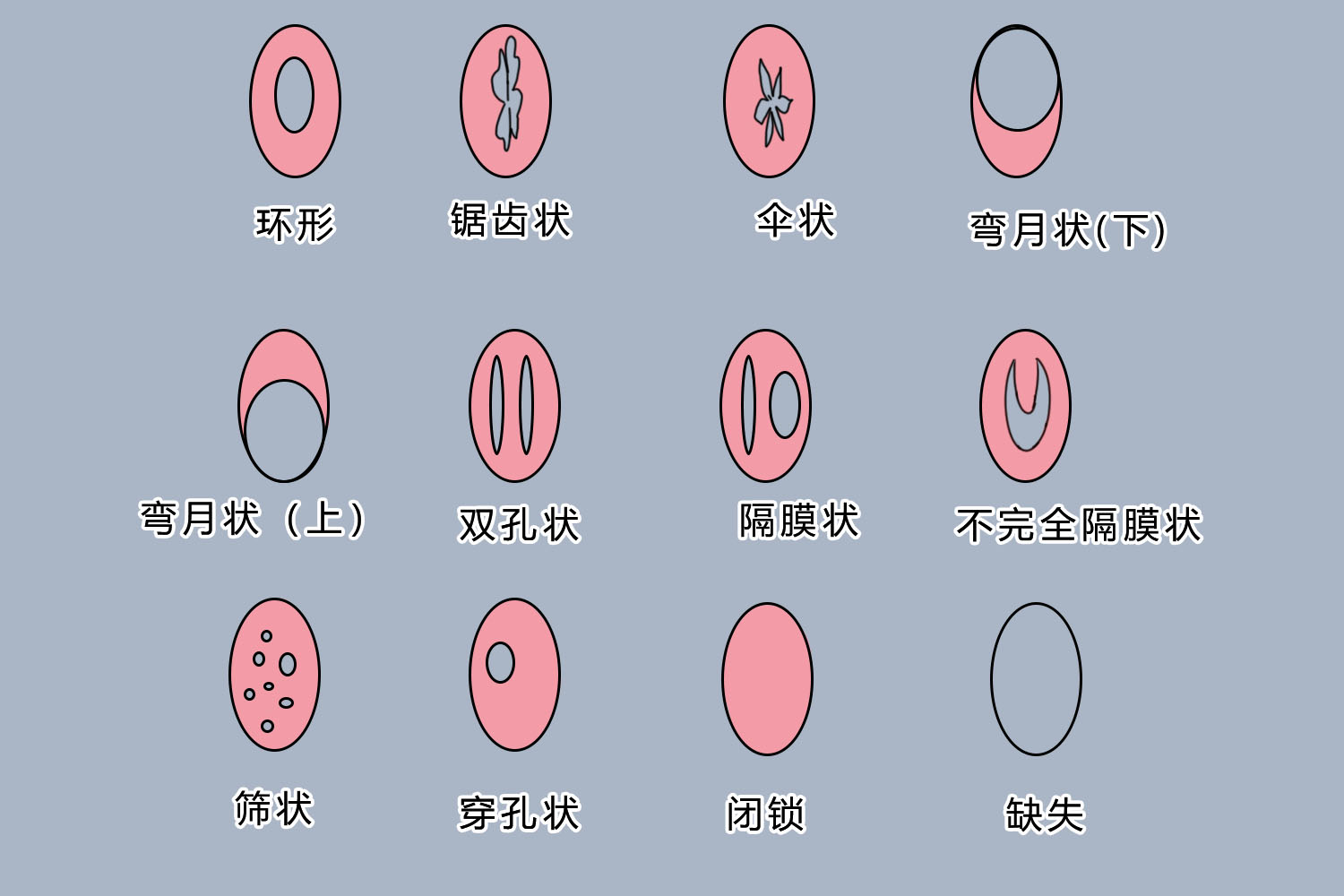 形状各异的处女膜