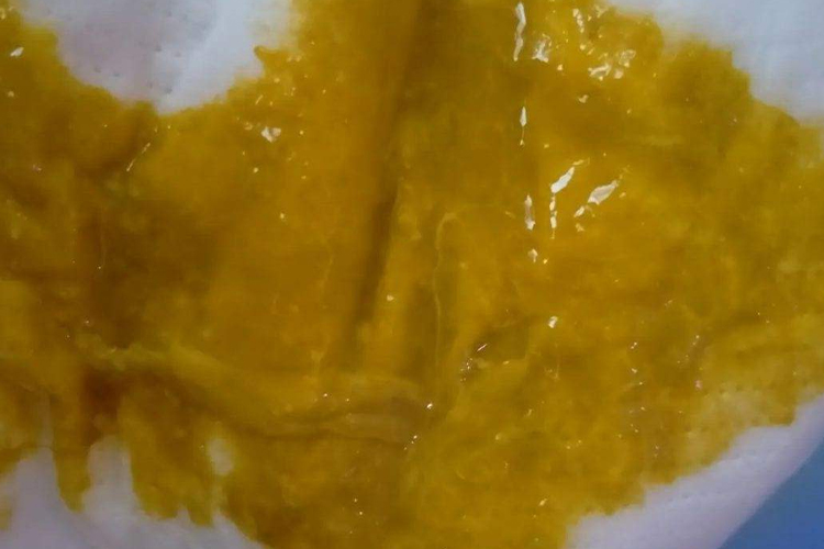 正常的婴儿大便粘稠糊状图