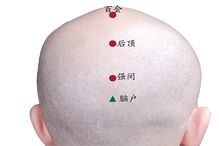 后顶、强间穴位置图