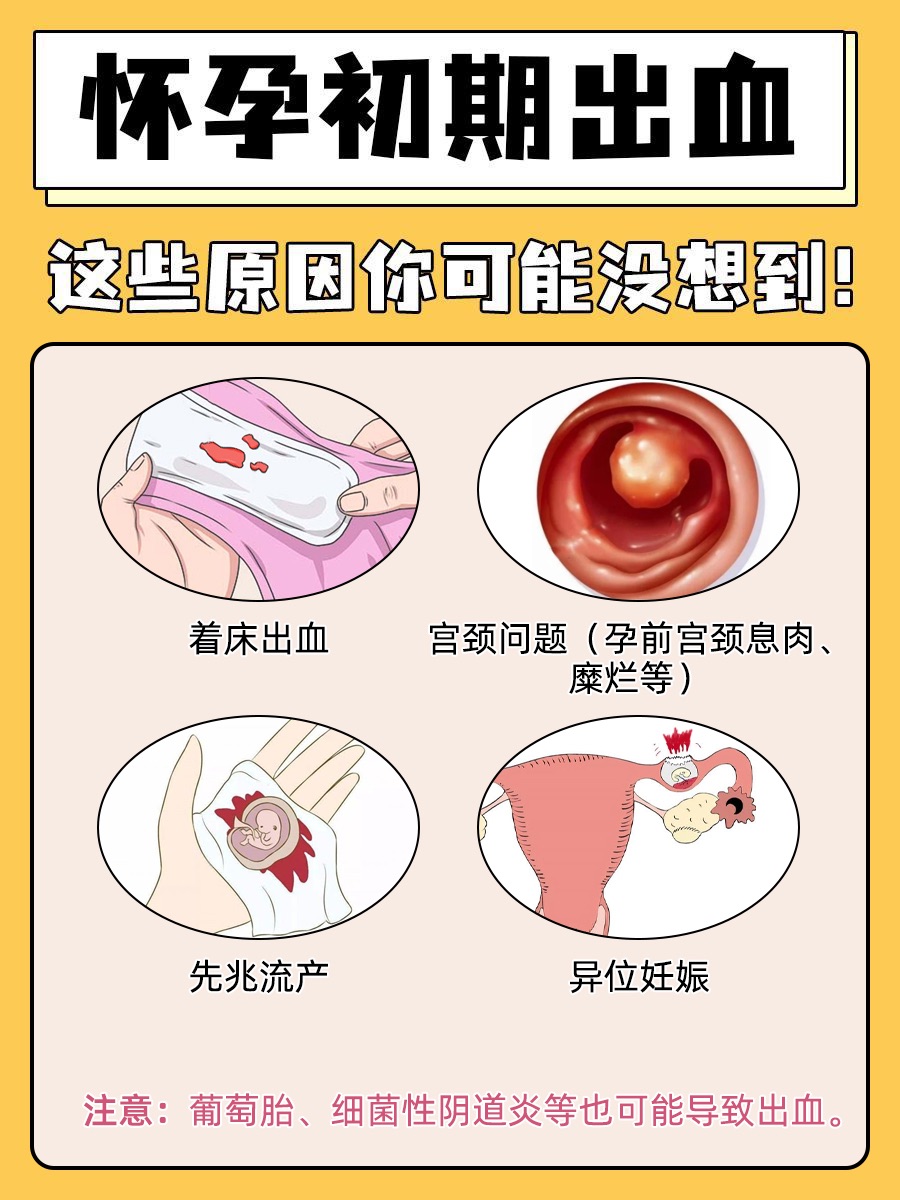 怀孕初期出血,这些原因你可能没想到！