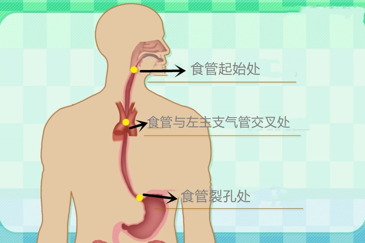 食管3个狭窄处位置图