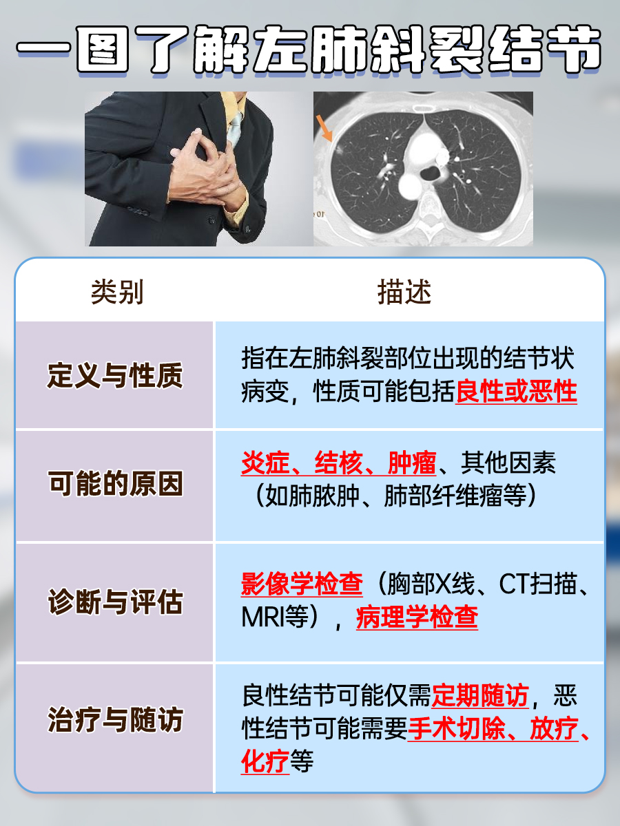 左肺斜裂结节是什么意思?一文了解