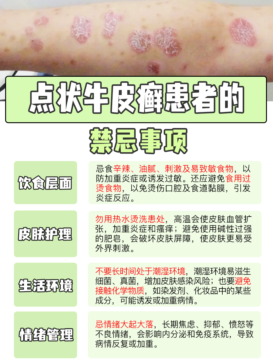 求解！点状牛皮癣：到底有无治愈的可能？