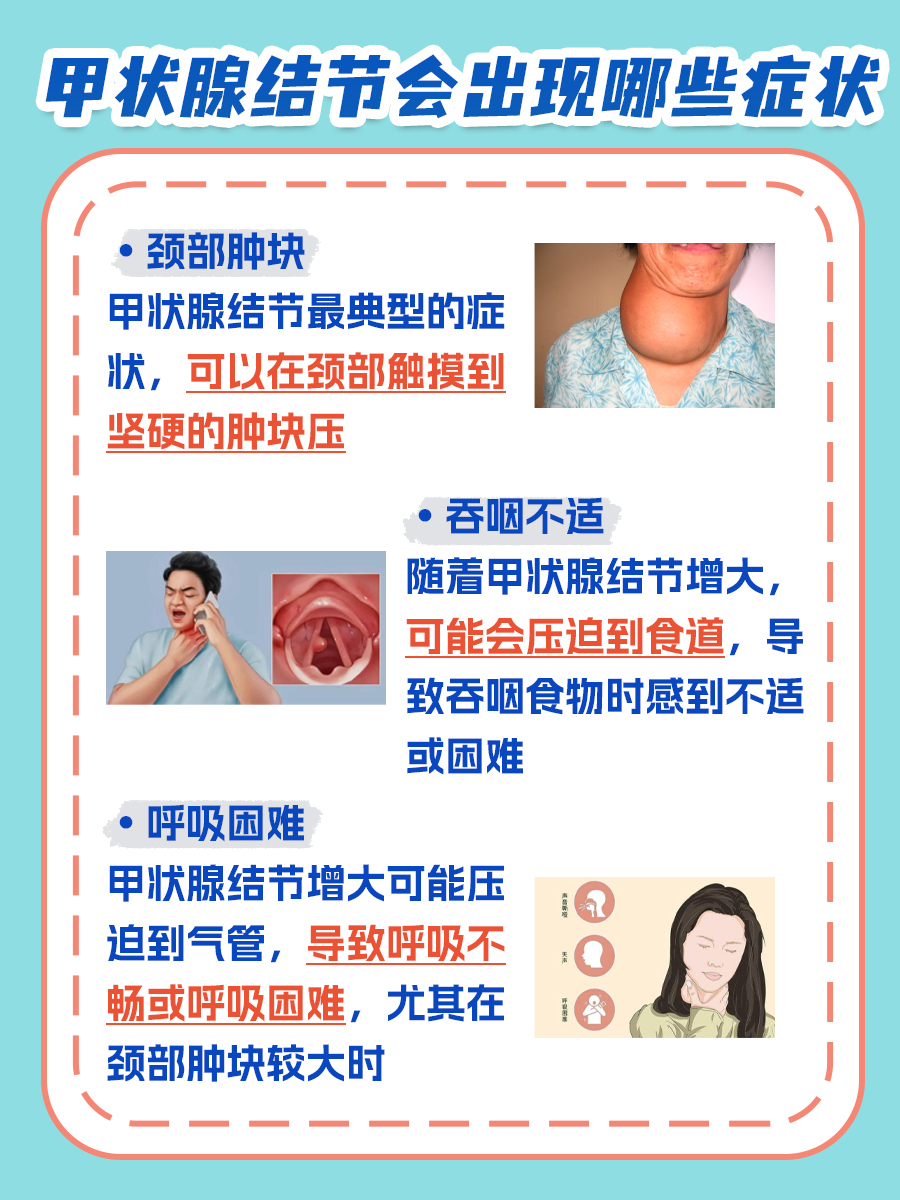 甲状腺结节治疗的好方法？三甲中医师来解答