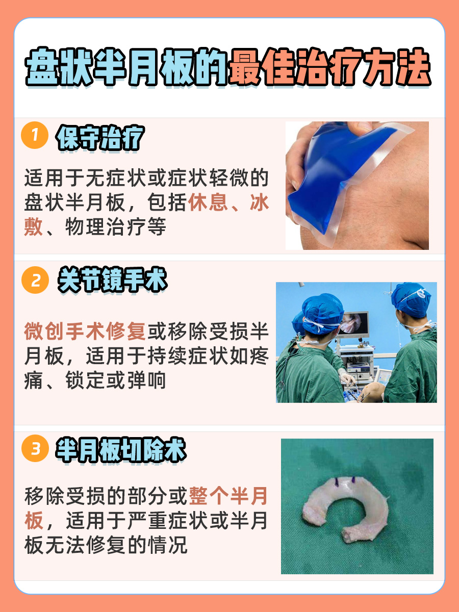 盘状半月板损伤：最佳治疗方案