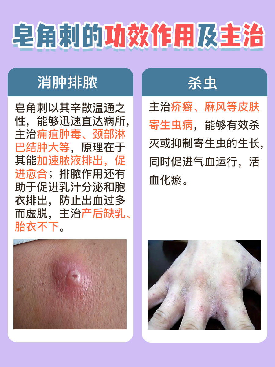 皂角刺功效作用大起底，主治病证一文览尽