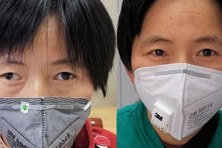 斜视手术前后对比图