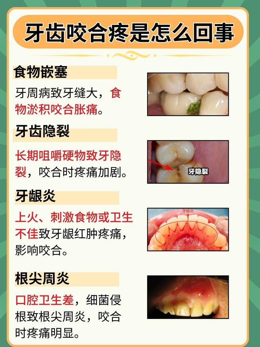 原因探究:牙齿咬合疼是怎么回事