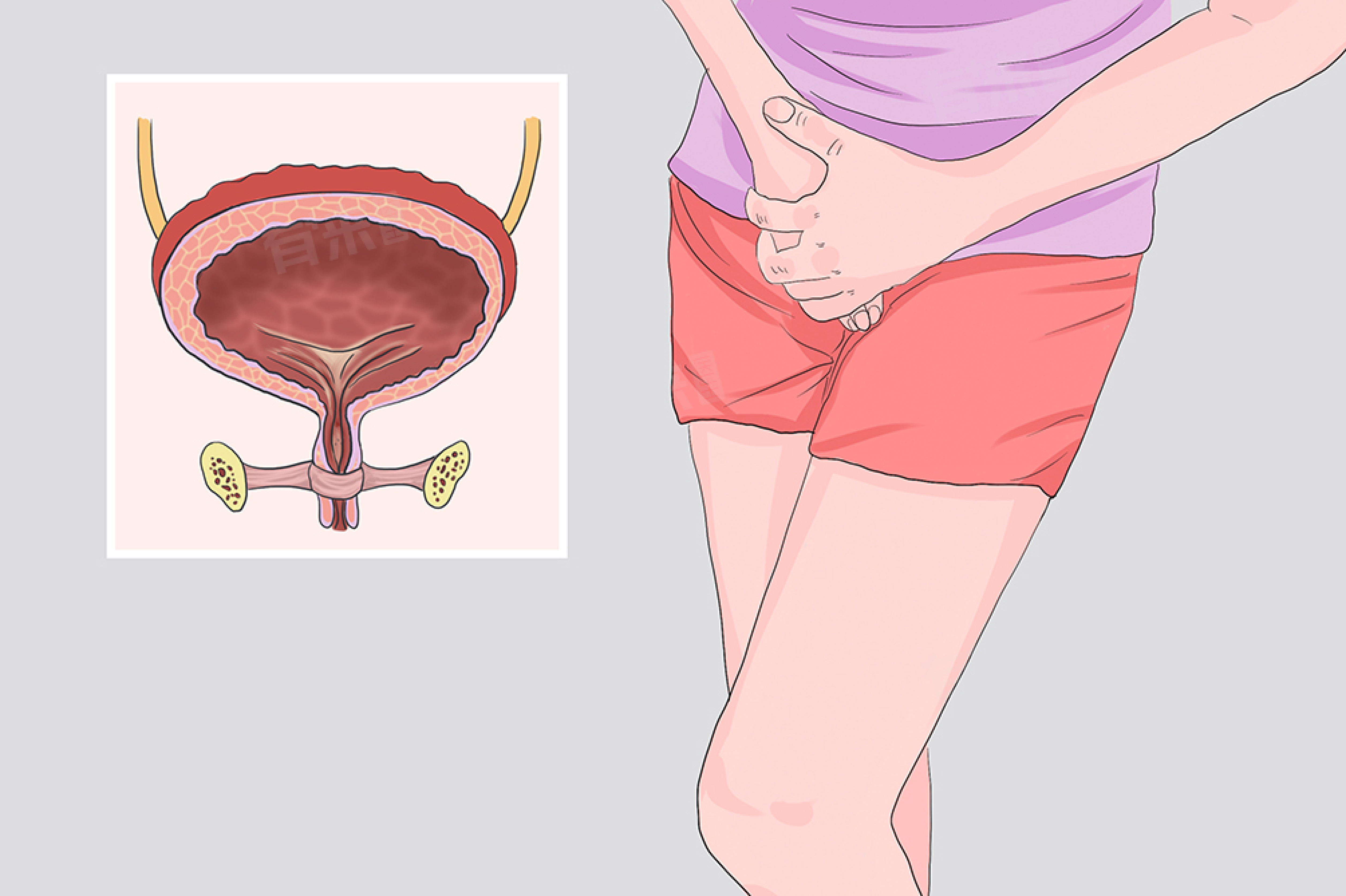 膀胱刺激征名词解释