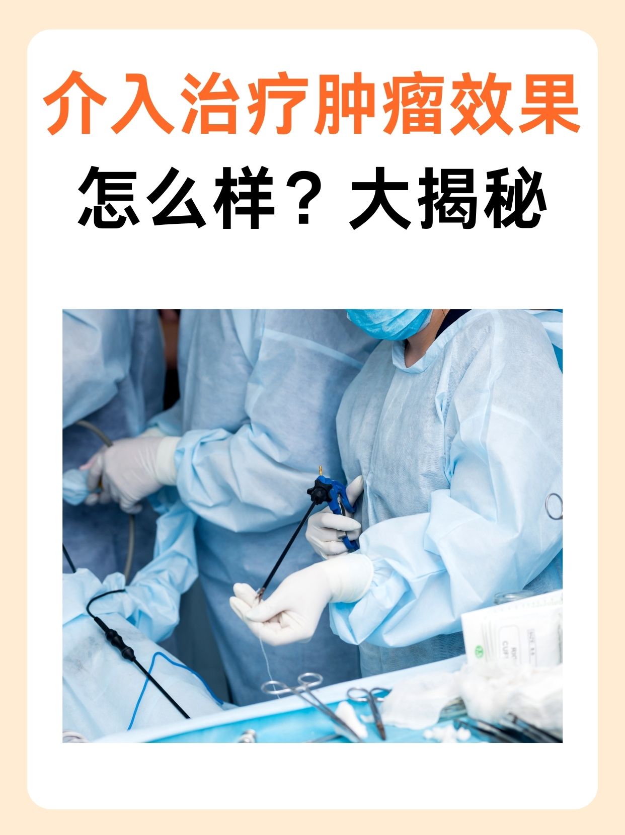 介入治疗肿瘤效果怎么样?大揭秘