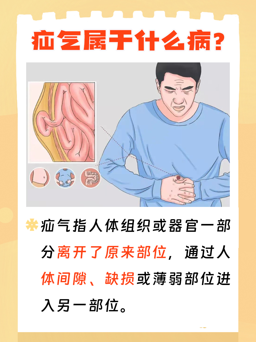 疝气是什么病？严重吗？怎么医治？