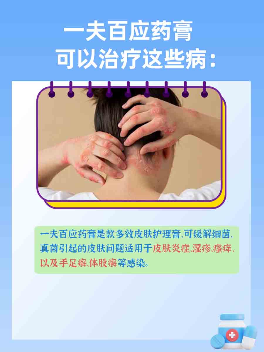 一文解析！一夫百应药膏可以治疗哪些病？