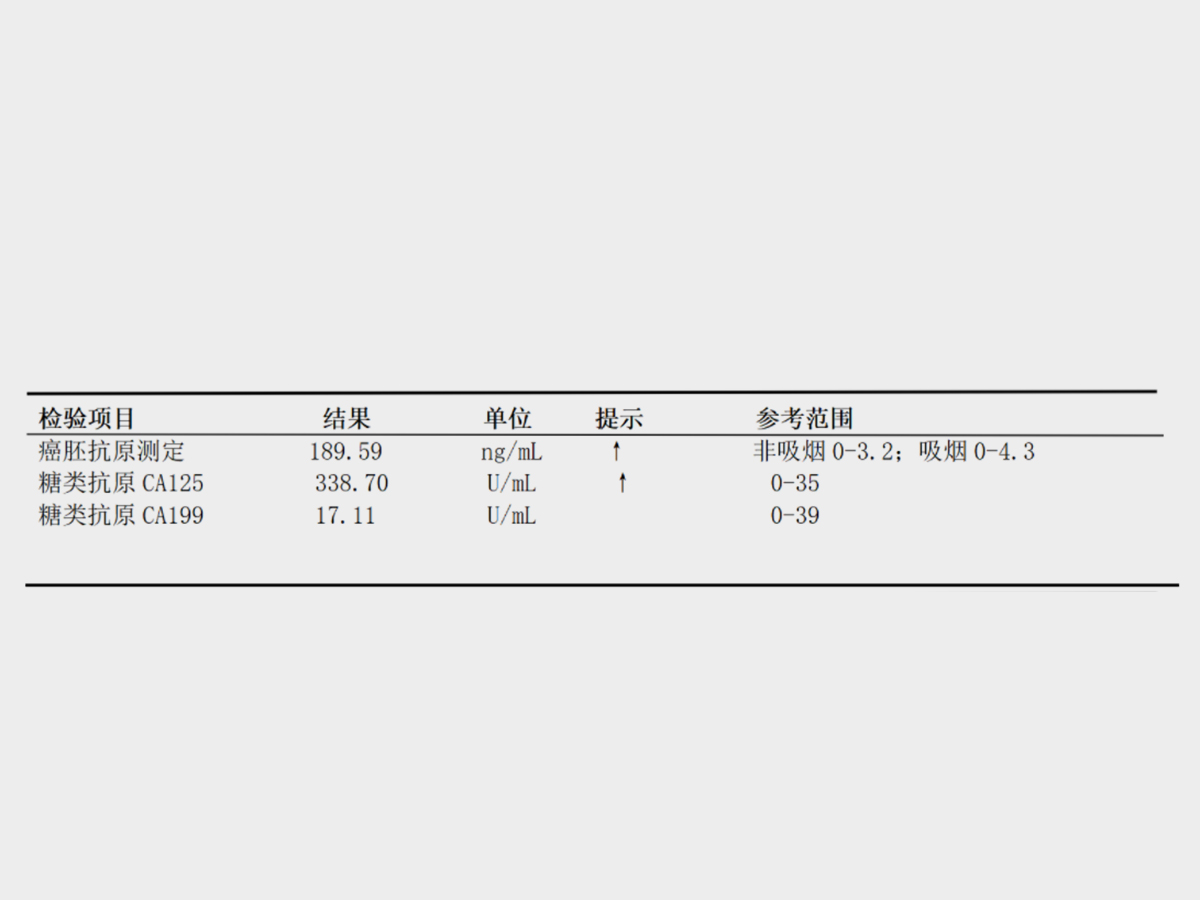 百全毫米波能治什么病肺腺癌早期不想手术？立体定向放疗也可缓解疾病！_https://www.jmylbn.com_新闻资讯_第1张