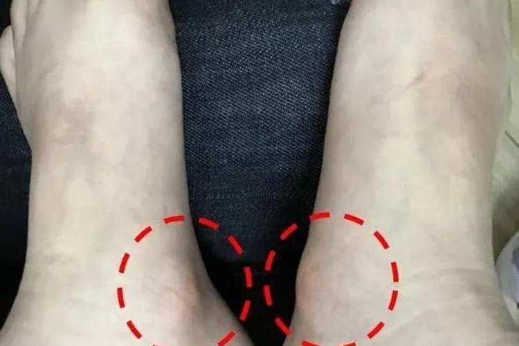 副舟骨疼痛部位图