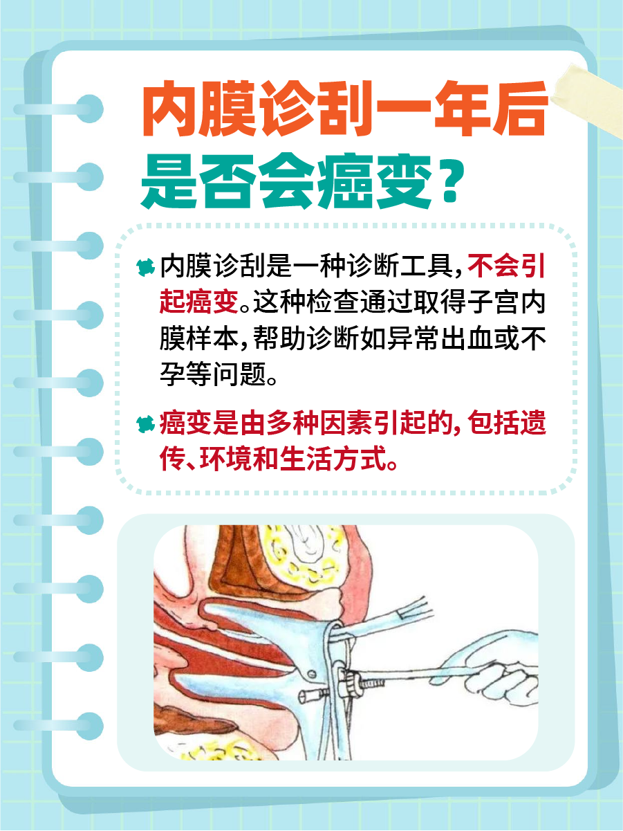 探究：内膜诊刮一年后癌变的可能性