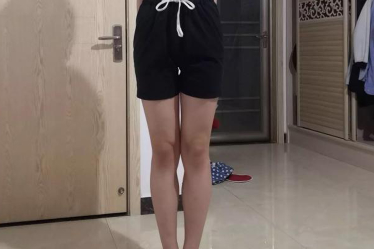 正常腿型示意图