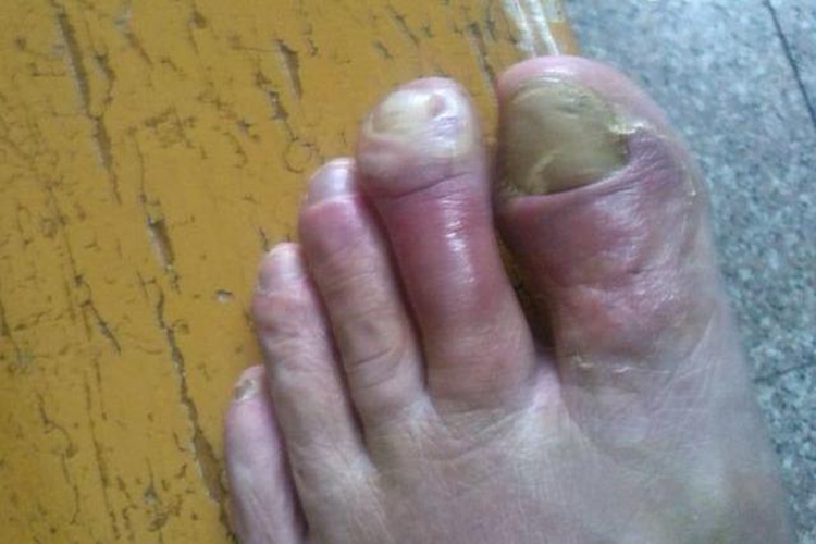 热毒壅聚无名肿毒图