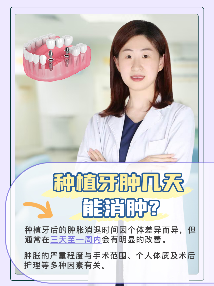种植牙肿几天能消肿？看完你就知道！