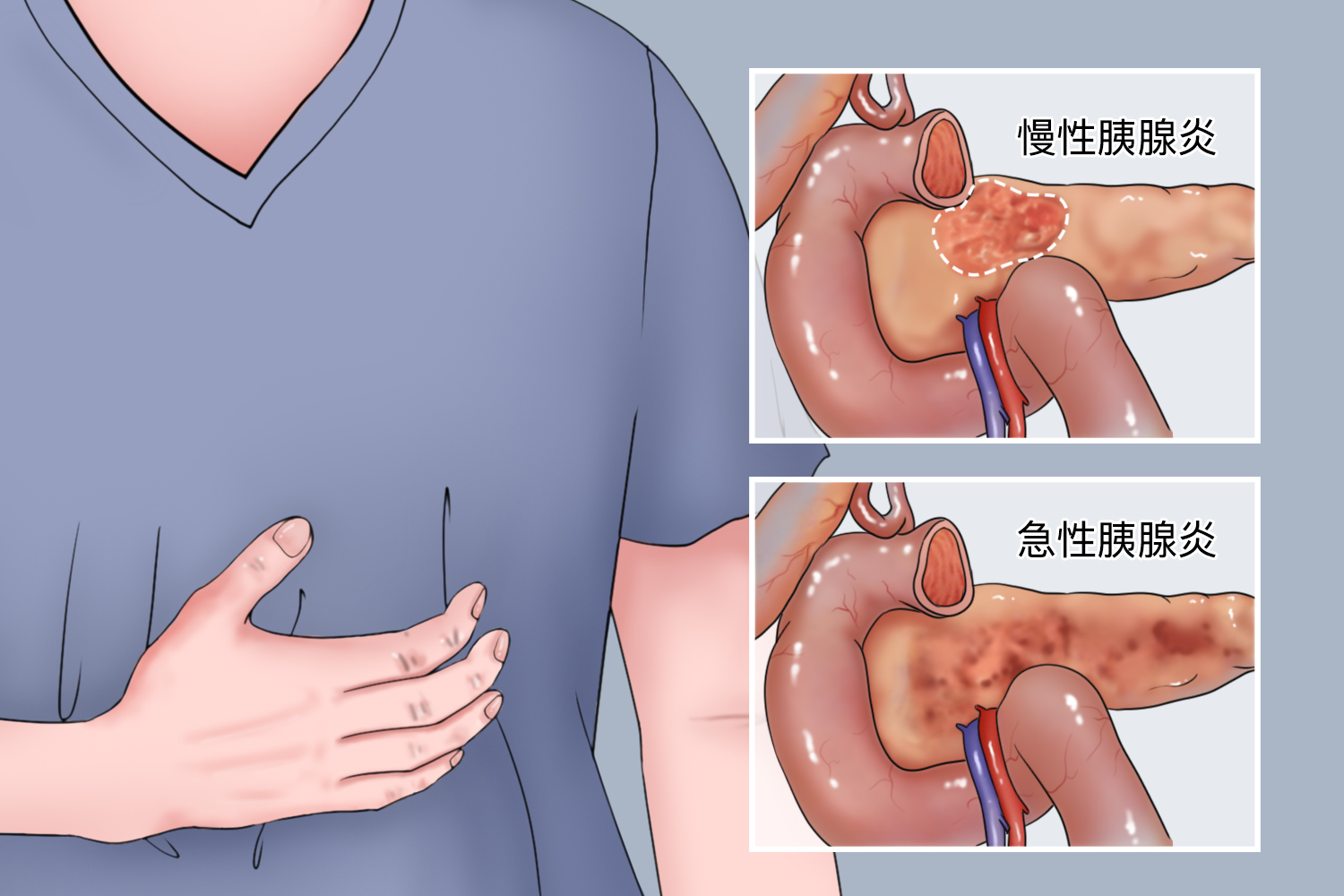 胰腺疼痛位置图