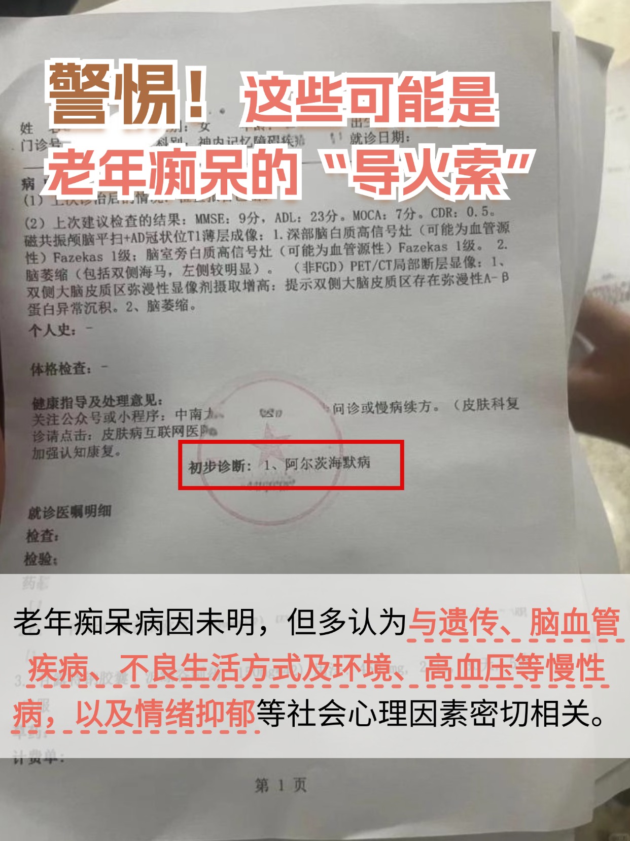 警惕!这些可能是老年痴呆的“导火索”