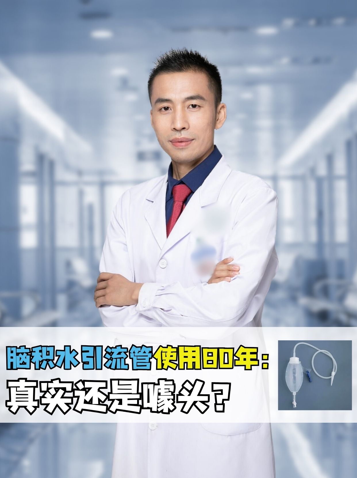 脑积水引流管使用80年:真实还是噱头?