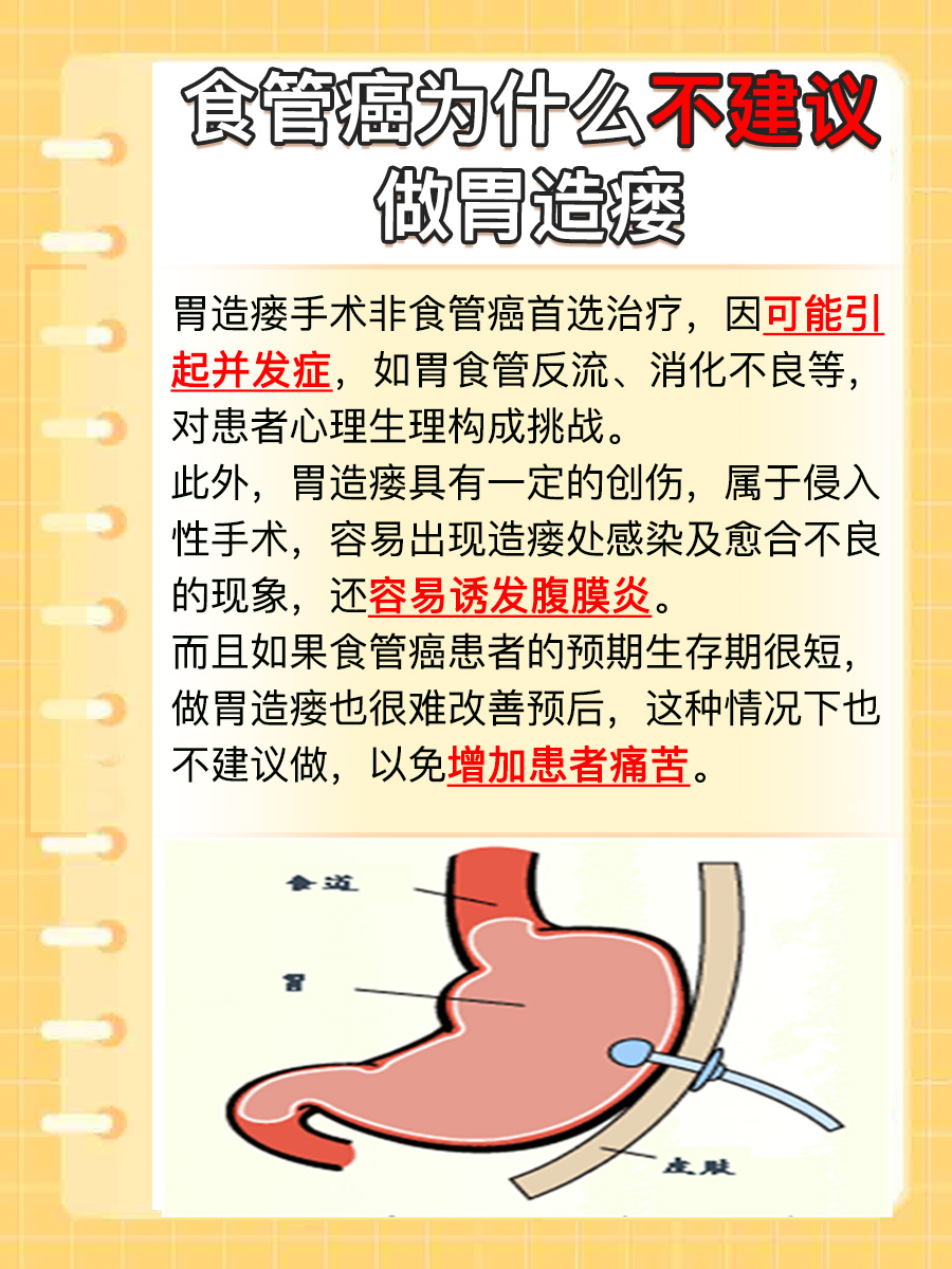 食管癌治疗为何规避胃造瘘?风险与考量解析