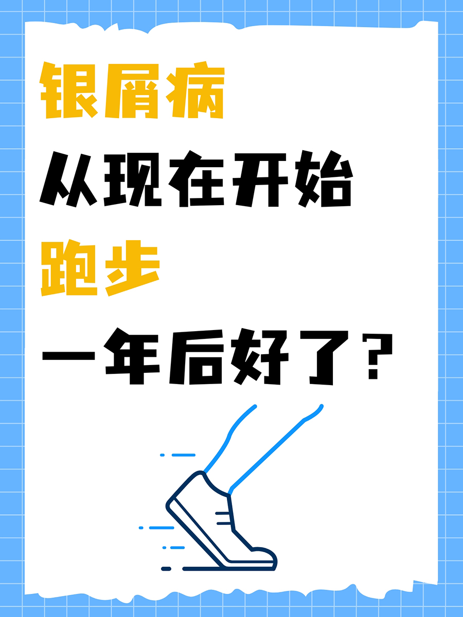 坚持跑步一年银屑病好了？要理性看待！
