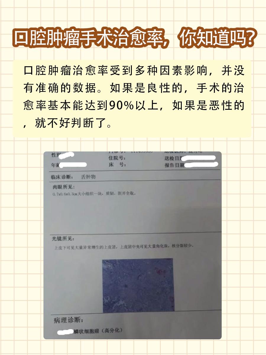 口腔肿瘤手术治愈率,你知道吗?
