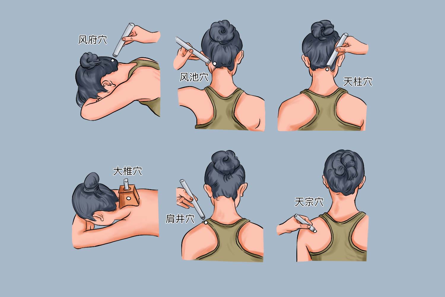 颈椎病艾灸部位图