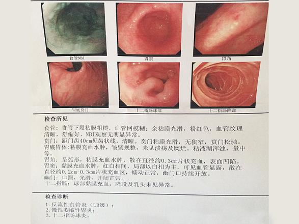 胃阴虚证.png