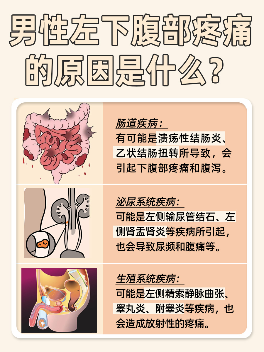 男性左下腹部疼痛，终于找到病因了