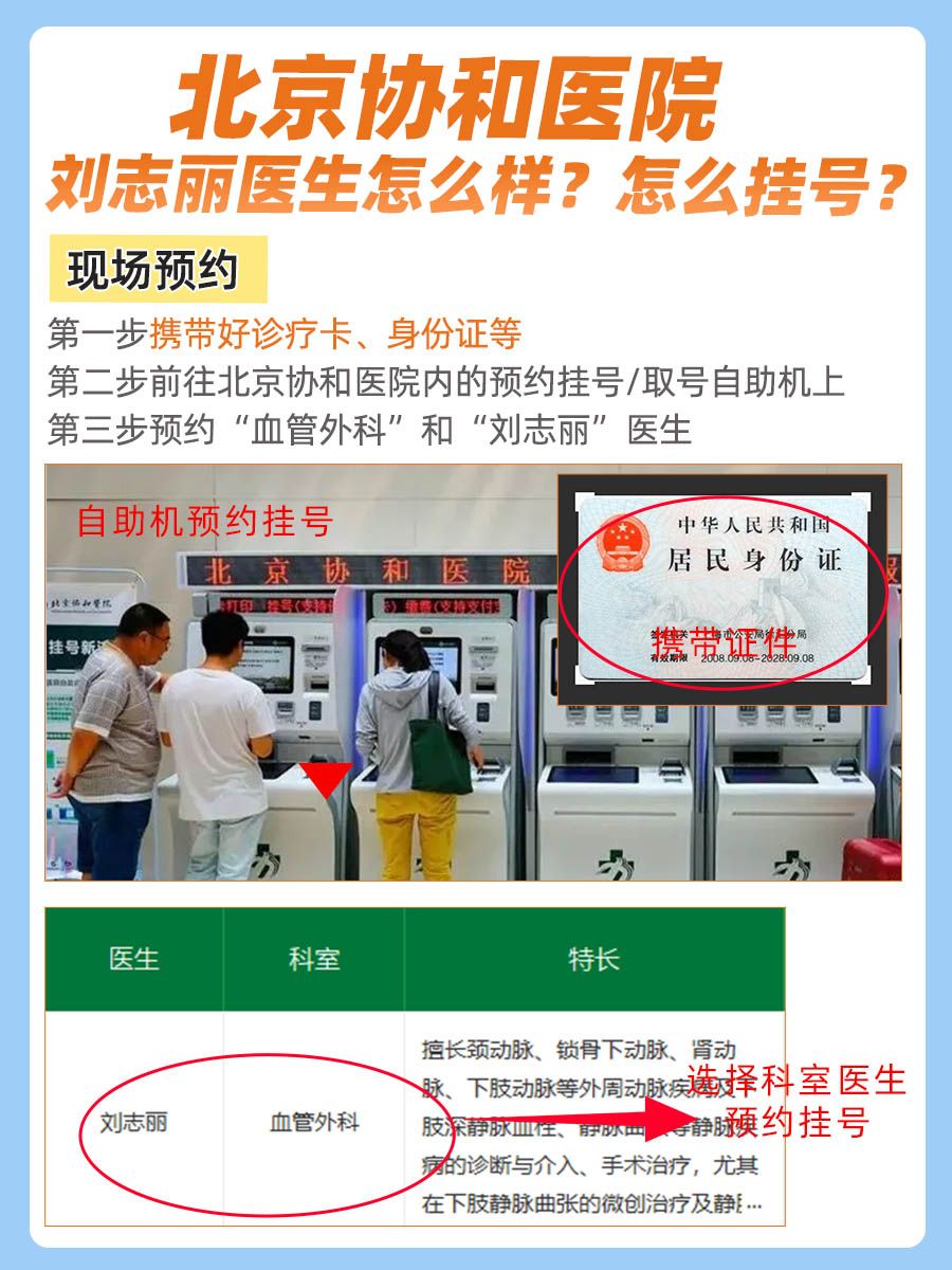 北京协和医院刘志丽医生怎么样？怎么挂号？