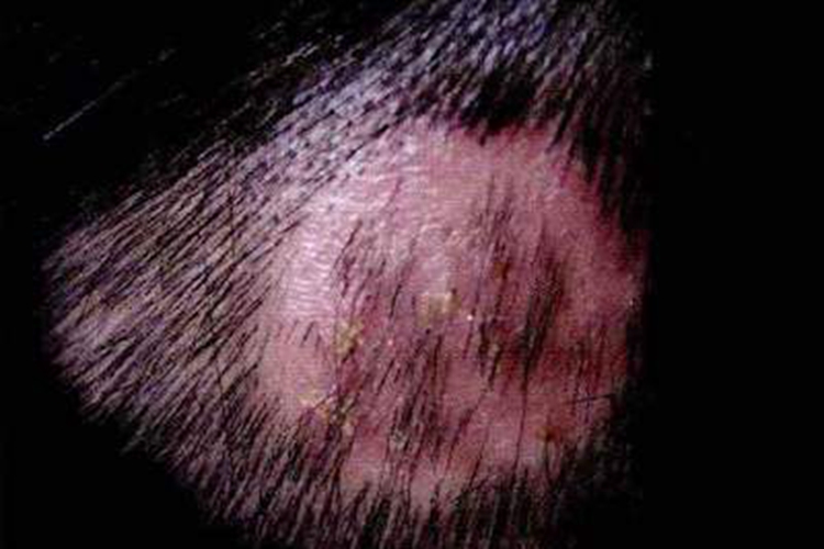 脓癣头皮上发红有肿块图 脓癣头皮上发红有肿块图