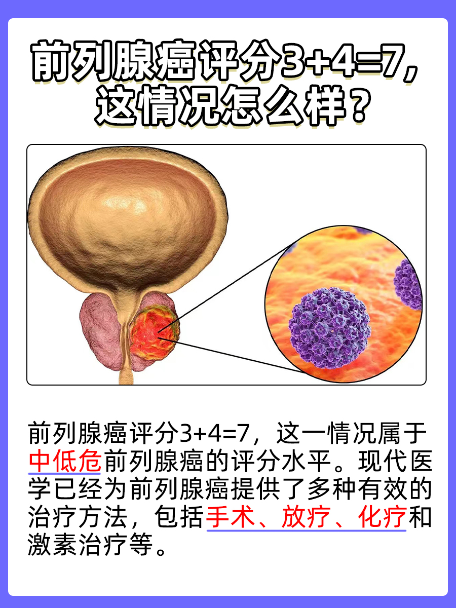 前列腺癌评分3+4=7,了解你的健康密码!