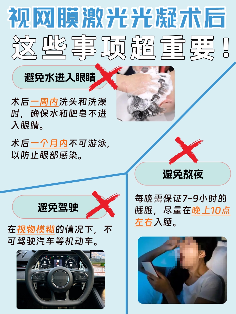 视网膜激光光凝术后恢复指南:休息日数详解