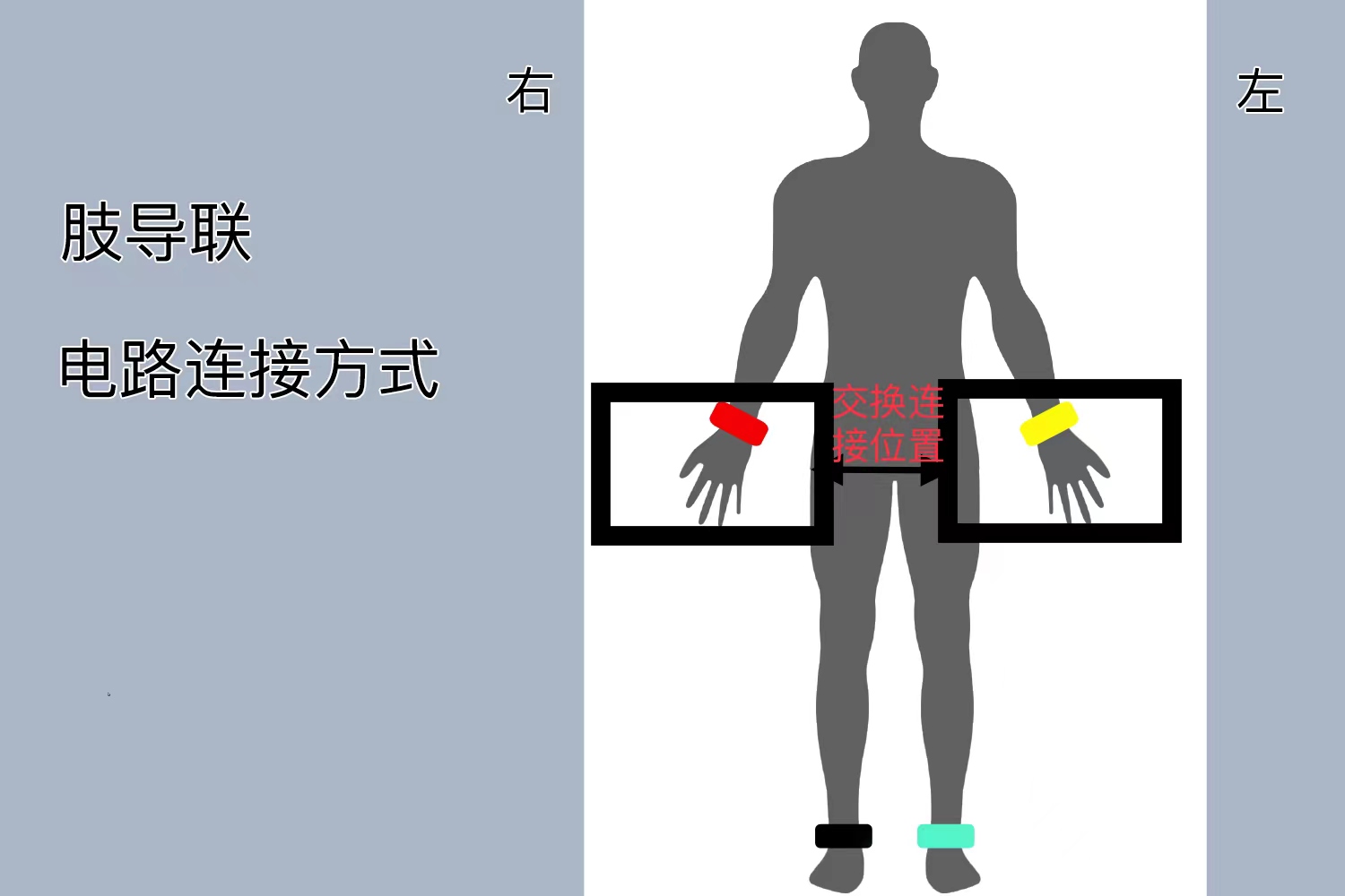 右位心肢体导联图