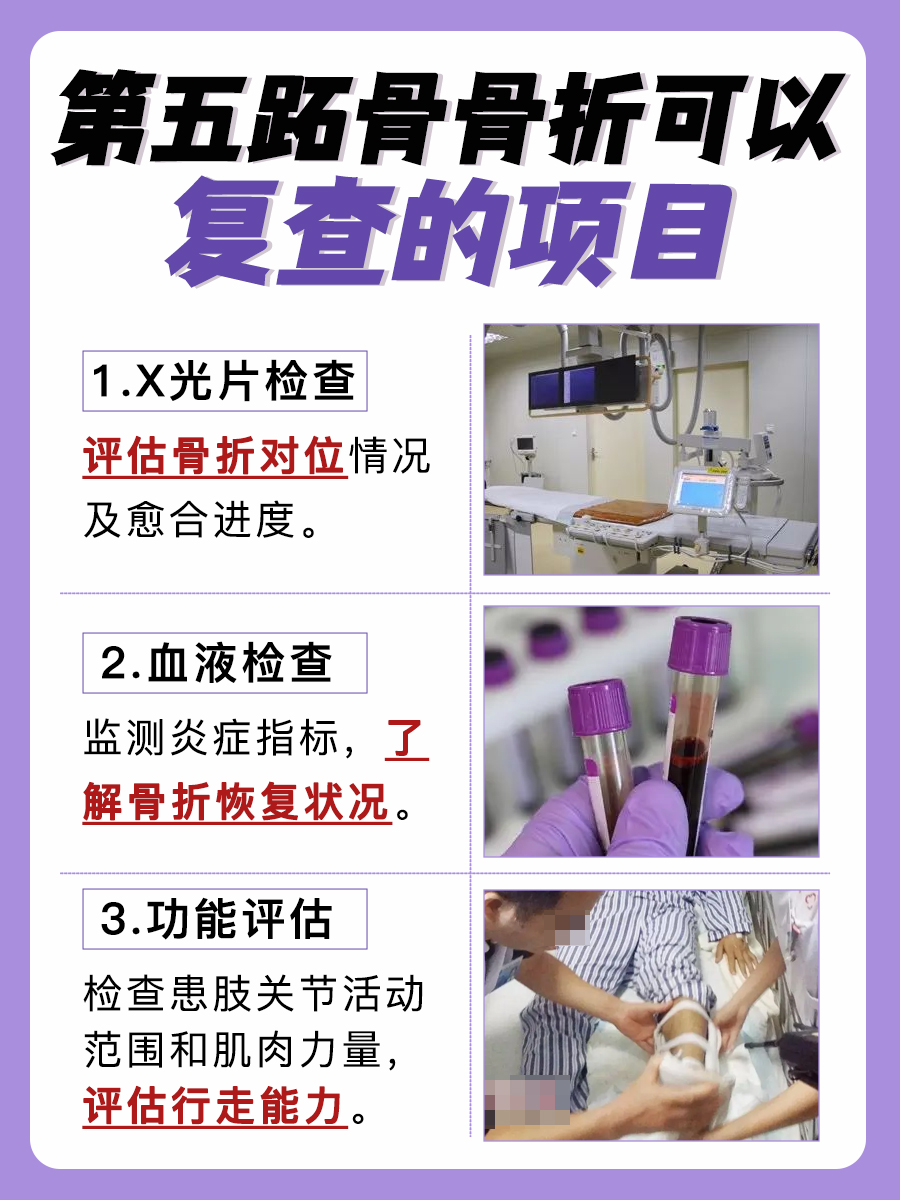 20天快速恢复！第五跖骨骨折后走路攻略