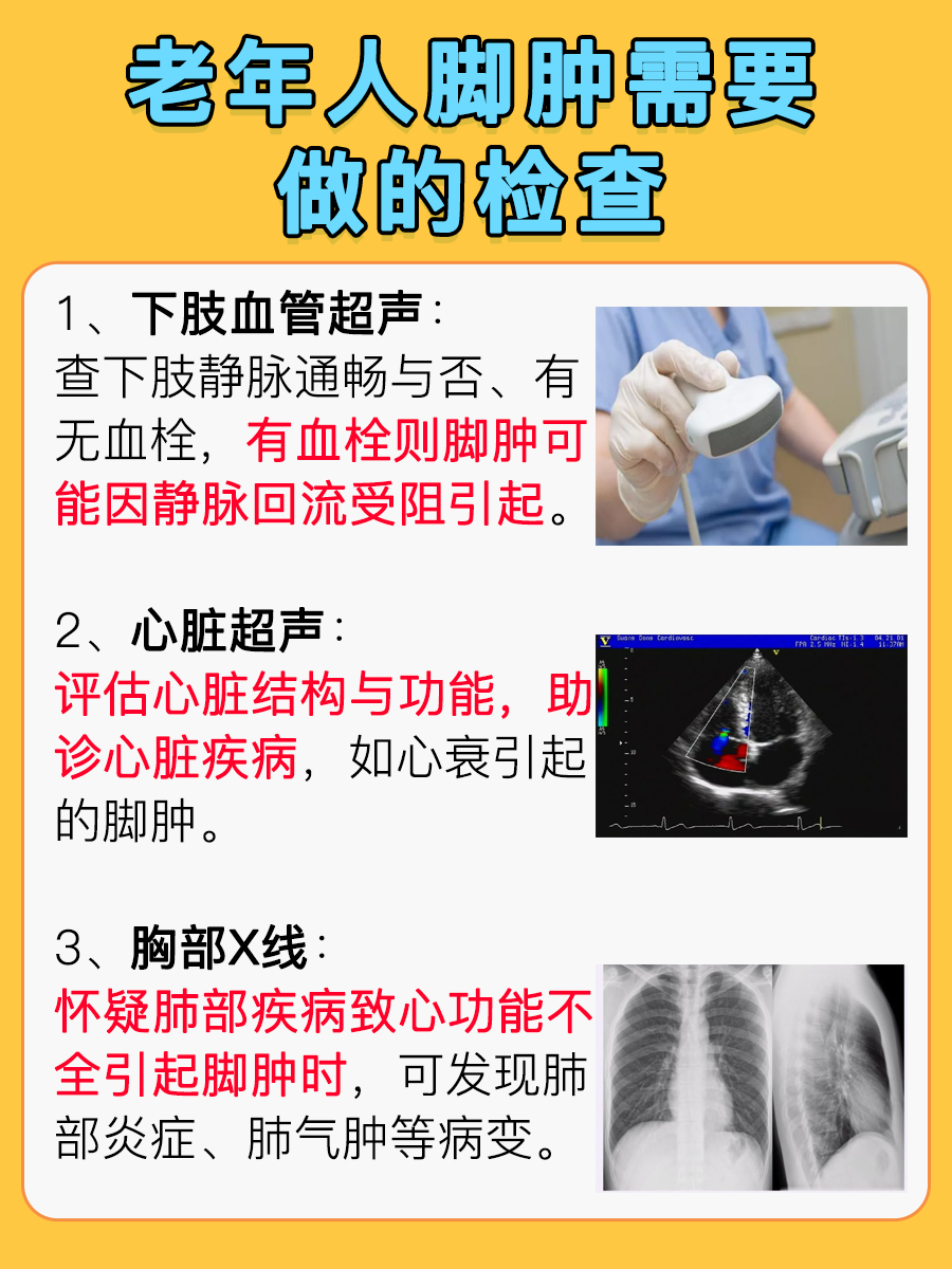 医生解答：老年人脚肿有什么好方法治