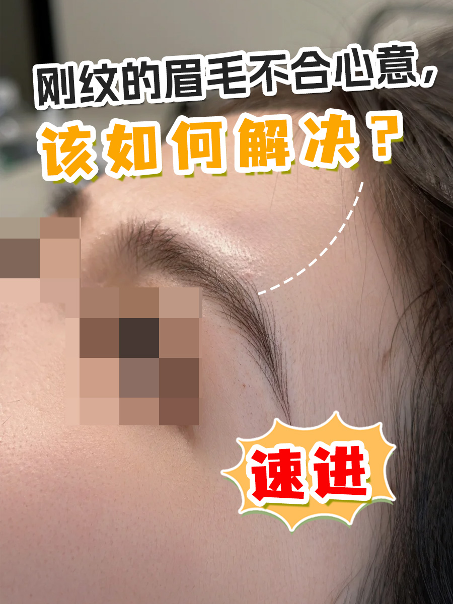 刚纹的眉毛不合心意，该如何解决？速进